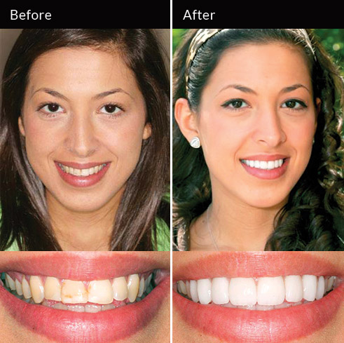 Advanced Cosmetic Dentistry