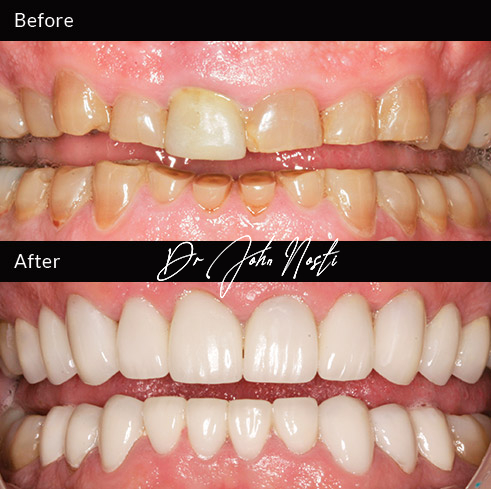 Advanced Cosmetic Dentistry