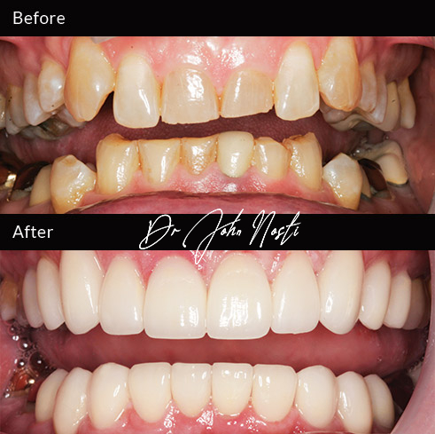 Advanced Cosmetic Dentistry