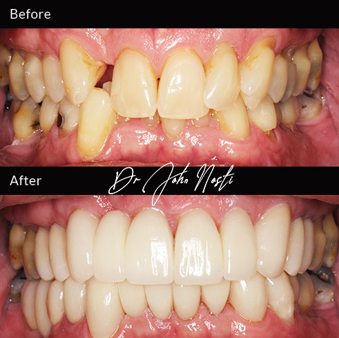 Advanced Cosmetic Dentistry