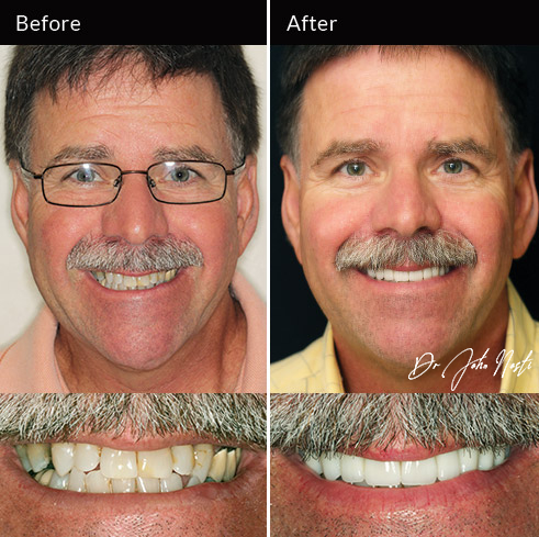 Advanced Cosmetic Dentistry