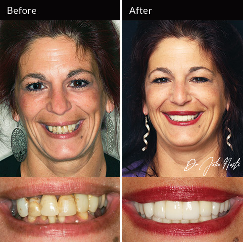 Advanced Cosmetic Dentistry