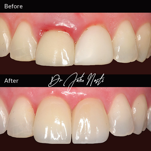 Advanced Cosmetic Dentistry