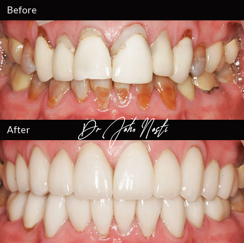 Advanced Cosmetic Dentistry