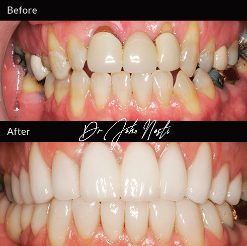 Advanced Cosmetic Dentistry