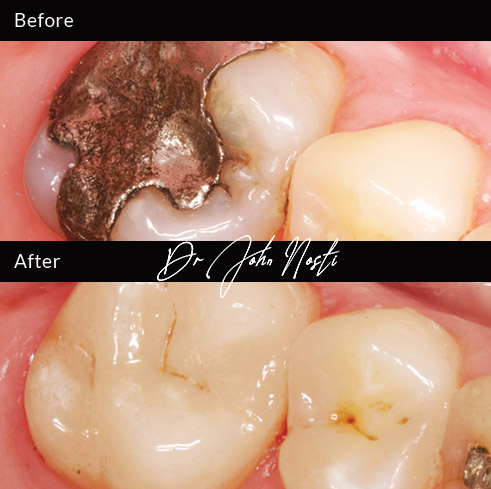 Advanced Cosmetic Dentistry