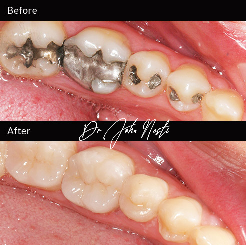 Advanced Cosmetic Dentistry