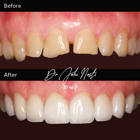 Advanced Cosmetic Dentistry