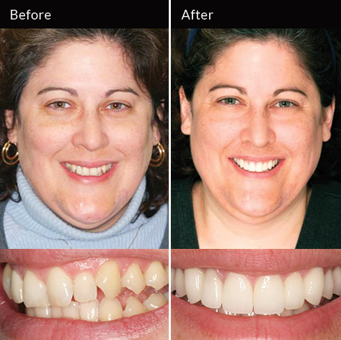 Advanced Cosmetic Dentistry