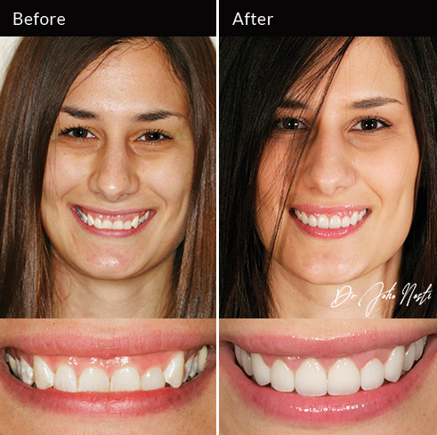 Advanced Cosmetic Dentistry