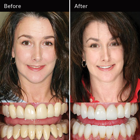 Advanced Cosmetic Dentistry