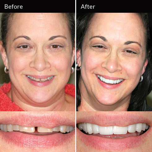 Advanced Cosmetic Dentistry