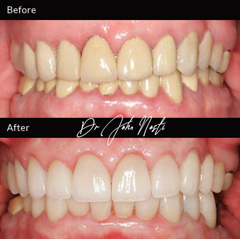 Advanced Cosmetic Dentistry