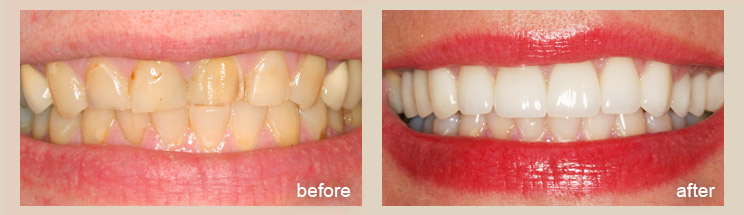 Advanced Cosmetic Dentistry